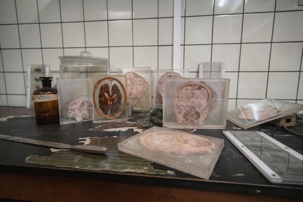 Human Brain Parts in an abandoned Anatomy School 