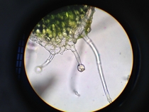 Glandular trichome one of the coolest pictures I have ever taken 